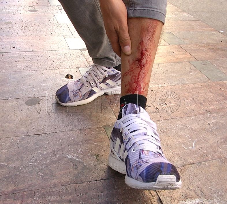 Ingresa en prisión preventiva el autor del apuñalamiento a un hombre