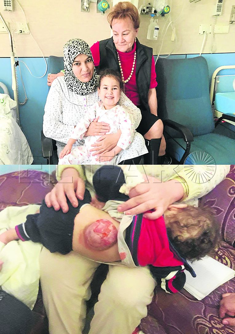 La operación devuelve la alegría a Marwa