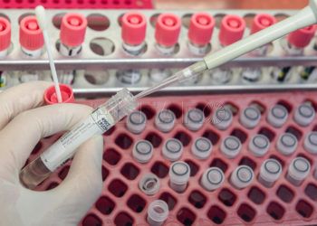 PCR-prueba-coronavirus