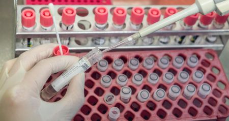PCR-prueba-coronavirus