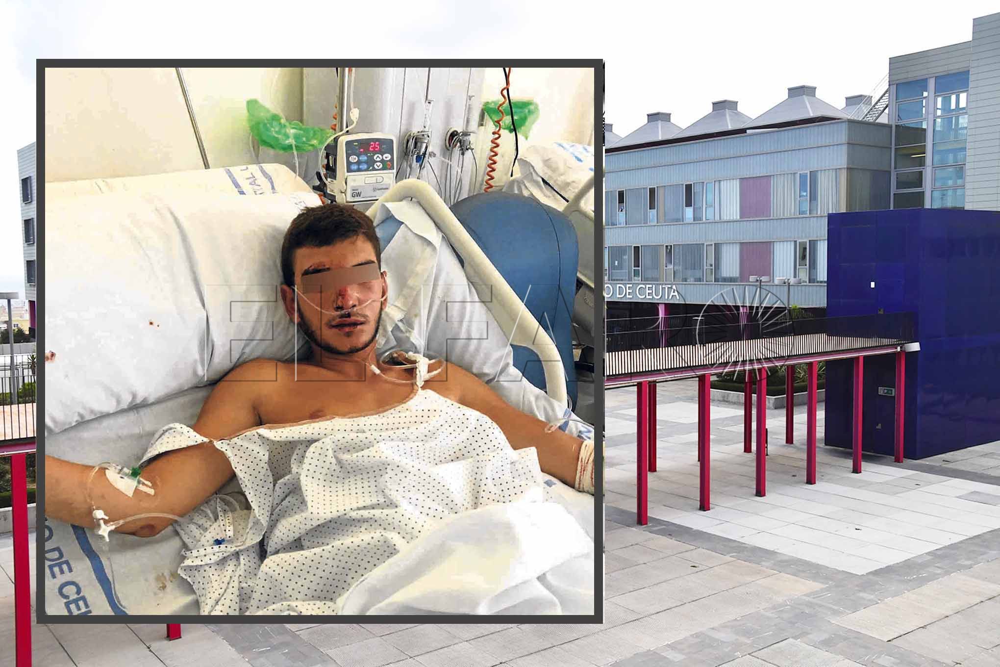 La Policía detiene a un menor, de Ceuta, por la brutal agresión a Omar
