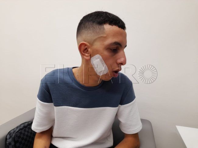 Unos menores le rajan la cara a un trabajador de Cruz Roja en el Tarajal