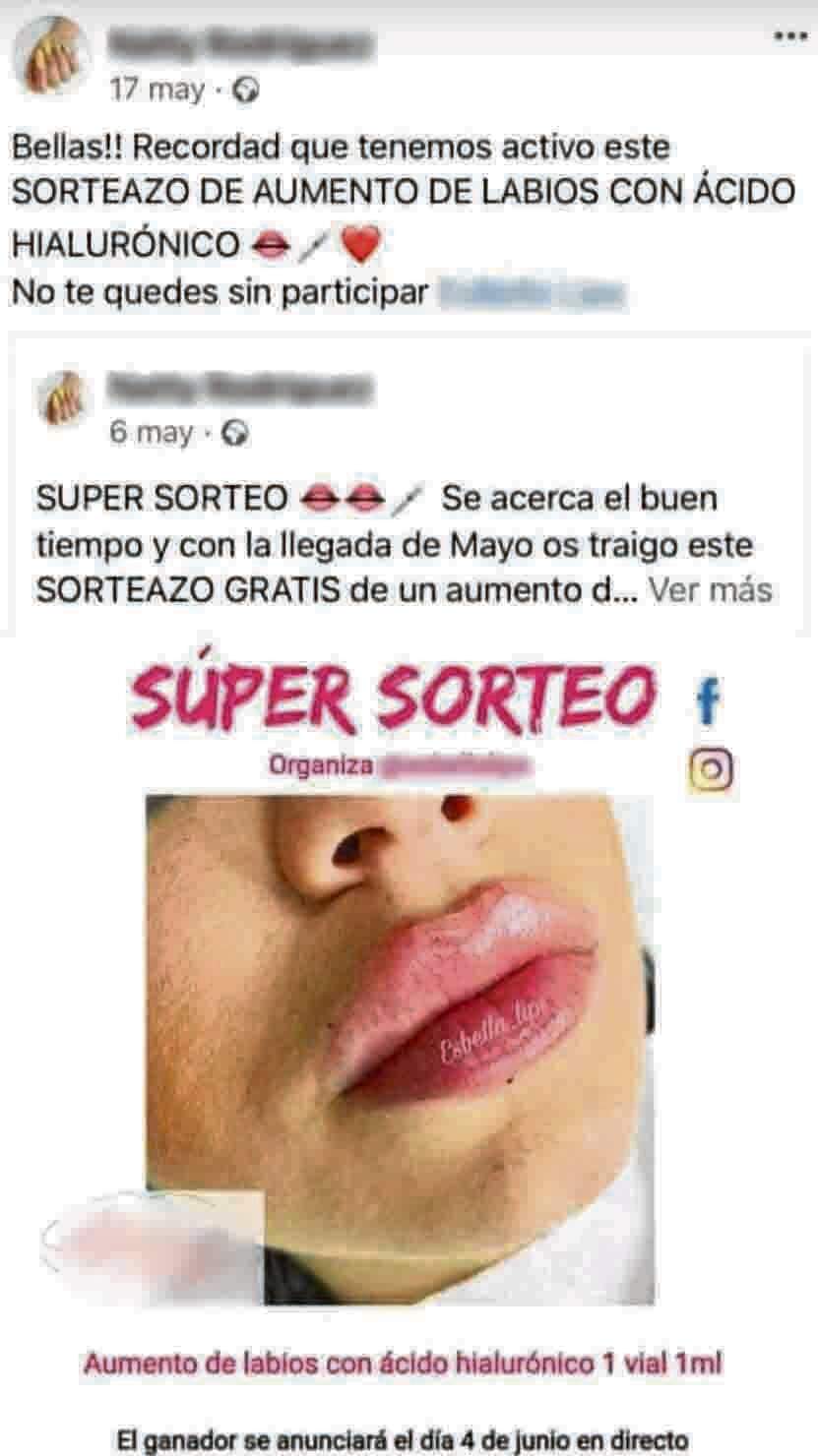 estafa-aumento-labios-cursos-estetica-anuncio