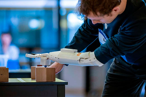Crean prótesis de brazo robótico 3D y trabajan para incorporar mano y dedos