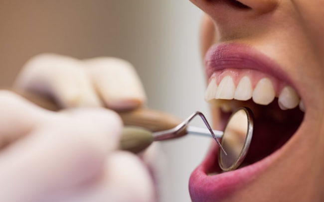 ¿Cómo solicitar las ayudas para la salud bucodental de menores en riesgo de exclusión?