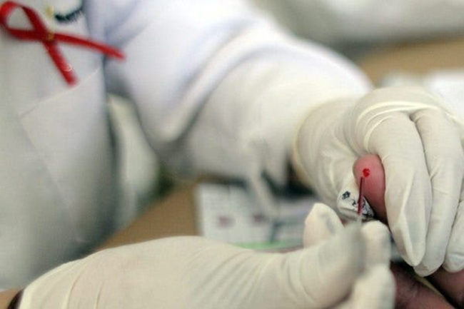 Los pacientes con VIH ya pueden donar órganos para trasplantes