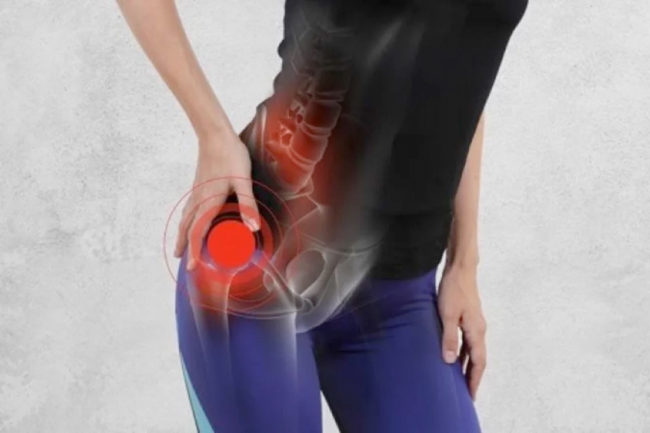 ¿Sufres de dolor en la cadera?